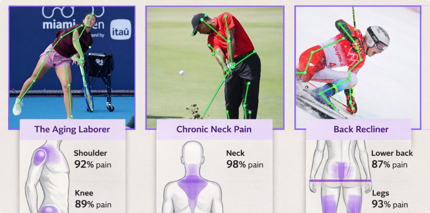 MyoAI，康复医学大模型
